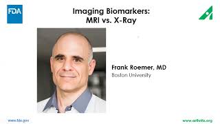 Imaging Biomarkers - MRI vs. X-ray | Frank Roemer