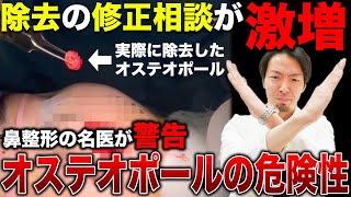 鼻のプチ整形オステオポール/オステオポアって危険なの？鼻整形の名医が危険性や副作用が出て整形失敗した際の修正方法について解説します。