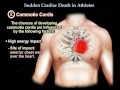 sudden cardiac death in athletes everything you need to know dr. nabil ebraheim