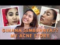 MY ACNE STORY - CERITA JERAWATKU YANG TERPARAH SEUMUR HIDUP SEJAK PANDEMI  - BERSAMA GLOSKIN!