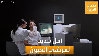 صباح العربية | علاج العيون بالخلايا الجذعية.. دراسة تفتح باب أمل جديد للمصابين