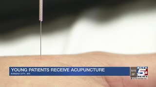 Children’s Mercy Hospital offers patients acupuncture to help ease pain