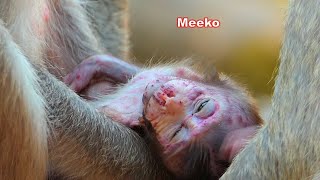 Condition of the baby Meeko before being rescued currently Baby Meeko is  under the care of NGO