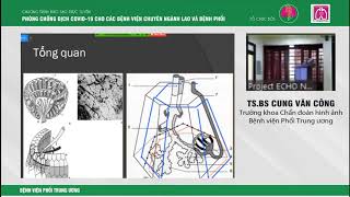 VILA - Chẩn đoán hình ảnh viêm phổi do Sars-Cov2