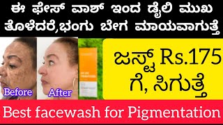 😱ಅಬ್ಬಾ ಈ facewash ಇಂದ ಮುಖ ತೊಳೆದರೆ ಎಷ್ಟು ಬೇಗ ಭಂಗು ಕ್ಲಿಯರ್ ಆಗತ್ತೆ ನೋಡಿ👆/bye bye pigmentation facewash