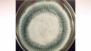 Identification of Filamentous Fungi: Hyaline Monomorphic Fungi: Part 5 [Hot Topic]