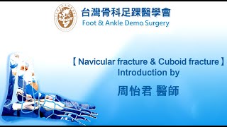 【Approach for navicular & cuboid fracture】Education video---Introduce by 周怡君醫師.