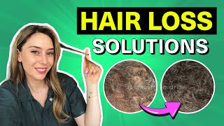 Hair Loss Treatments That Actually Work for Women & Men! | Dr. Shereene Idriss