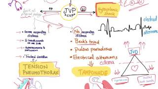 Shock in the setting of a trauma patient (Hypovolemic shock, Tension Pneumothorax, or tamponade)