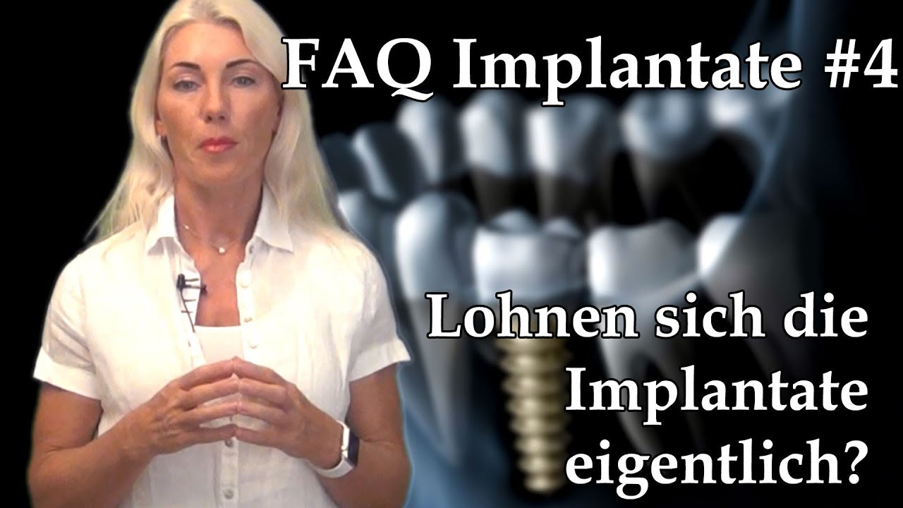 Implantat #4 Lohnen Sich Die Implantate Eigentlich? | Was Kostet Ein ...