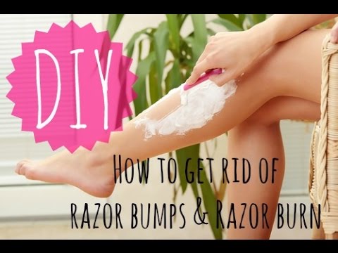 How to Get Rid of Razor Bumps and Razor Burn! | DIY How to Get Rid of Razor Bumps and Razor Burn! | DIY
