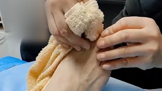 Extremely itchy athlete's foot - Athlete’s foot massage （2）【Athlete’s foot pedicure】