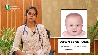 Down Syndrome - Explained by Dr Priyadharshini | Causes | Symptoms | Treatments | MDC Salem