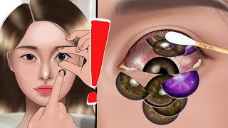 ASMR Removal of many contact lenses from the eye👁 Animation, oshi no ko