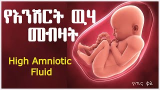 የእንሽርት ዉሃ መብዛት || High Amniotic Fluid