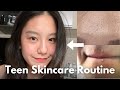 How to Create Your Own Skincare Routine for Teens (affordable & simple) I Teen Korean Skincare