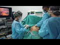 laparoscopic cholestectomy surgery with all its stages