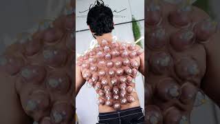 #drycupping #cuppingtherapy #cupping #shorts #shortsfeed #trending #trendingshorts #modeling
