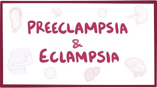 Preeclampsia & eclampsia - causes, symptoms, diagnosis, treatment, pathology