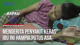 BAPAU ASLI INDONESIA - Menderita Penyakit, Hampir Buat Putus Asa [24 September 2020]