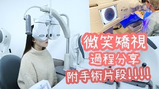 微笑矯視過程分享-附手術片段!!!!▲雅軒女生二三事 [[中字]]