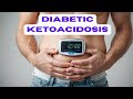 Diabetic Ketoacidosis