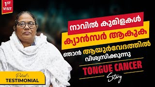 നാവിൽ കുമിളകൾ ക്യാൻസർ ആകുക. ഞാൻ ആയുർവേദത്തിൽ വിശ്വസിക്കുന്നു || Tongue Cancer Survivor Stories