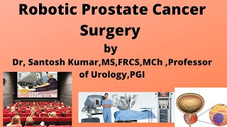 Robotic Prostate cancer surgery| रोबोटिक प्रोस्टेट कैंसर सर्जरी |Dr.(Prof)Santosh Kumar PGI