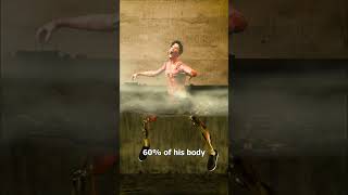 He Fell Into Boiling Water