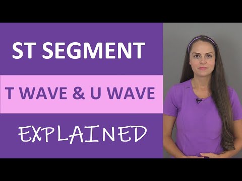 What does ST elevation mean for the heart?
