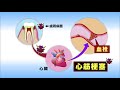 いわて元気○（マル）【全身にも影響・歯周病】（2018 3 28放送　ニュースプラス１いわて）