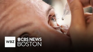 How to treat "pink eye" and when to call your doctor
