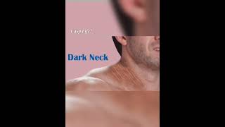 കഴുത്തിലെ കറുത്ത നിറം /Dark Neck #health #malayalam #symptoms #tips #shorts #hormones