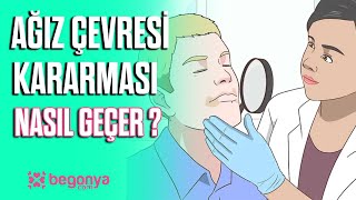 Ağız Çevresinde Kararma Neden Olur / Nasıl Geçer