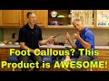 Foot Callous? This Product is AWESOME!