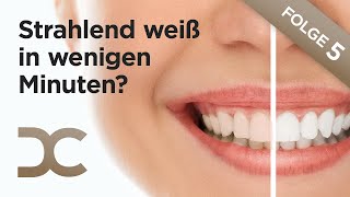Teeth whitening: A Hollywood smile in just a few minutes? Power bleaching, results, costs - Episo...