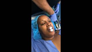 General Anesthesia live streamed