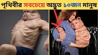 এদের শরীরের অঙ্গ প্রত্যঙ্গ আমাদের থেকে সম্পূর্ণ আলাদা l 10 People You Won't Believe Existed