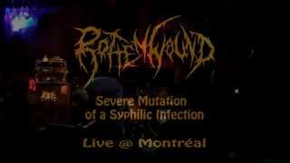 Rotten Wound  - Severe Mutation of a Syphilic Infection (Live)