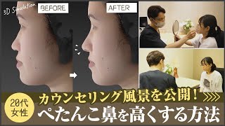 鼻が低い・ぺたんこ鼻を美容整形でどう治す？20代女性の鼻整形のカウンセリングをお見せします【リッツ美容外科】#鼻整形