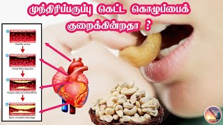 முந்திரி உடலின் கெட்ட கொழுப்பைக் குறைத்து நல்ல கொழுப்பின் அளவை அதிகரிக்கின்றதா