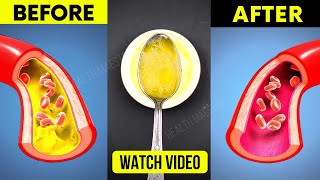 Just 1 Tablespoon Per Day Unclog Clogged Arteries and Lower Bad Cholesterol