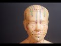 SCALP ACUPUNCTURE: Yamamoto New Scalp Acupuncture (YNSA)