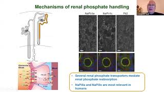 Update in Management of Hyperphosphatemia in Patients with CKD