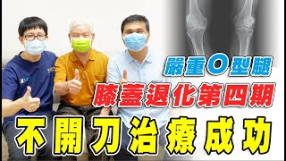 名冠診所【膝關節退化治療】​創新中醫西醫合作免開刀 治療膝關節退化第四期