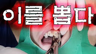 교정 발치하는 분들 꼭 보세요!! 겁내지마세요!!   - #발치교정, #발치과정 ,#발치하는이유