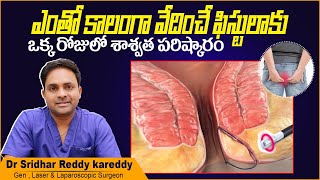 How to Cure Fistula Permanently? | Laser Treatment for Fistula in Telugu | Treatment Range Hospital