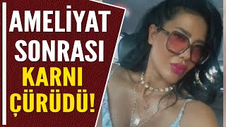 AMELİYAT SONRASI KARNI ÇÜRÜDÜ!