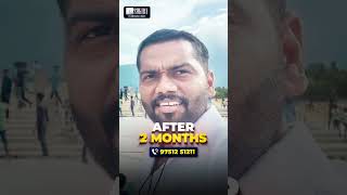 🤩 2 Month Hair Transplant Results Before \u0026 After | Tamil Hair Transplant | Sukira Aesthetic #shorts