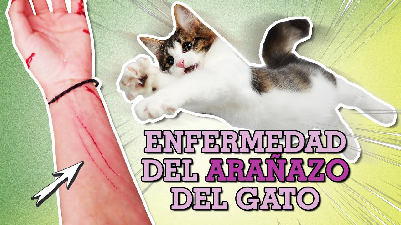 Enfermedad Del ARAÑAZO Del GATO 🐱👱👩 | ¿Afecta A Gatos Y A Humanos ...